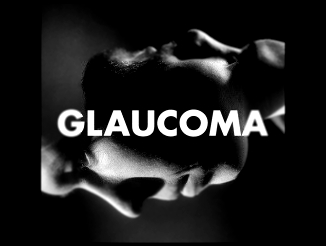 Подборка Glaucoma - I Can (Original Mix)
